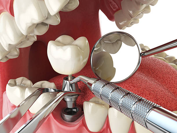 Best Weekend Emergency Dentist in East Basin, UT